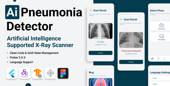 Flutter TensorFlow  Artificial Intelligence Detection of Lungs Pneumonia COVID 19 [2023 Update]