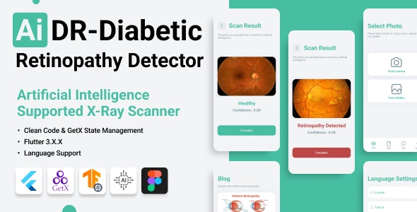 Flutter TensorFlow Artificial Intelligence Application Detection of Diabetic Retinopathy (2023)